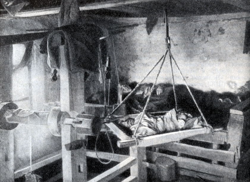 Голодный тиф 1891 г. Фотография.