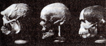 Сравнительная реконструкция черепов «пильтдаунского человека» (справа), человека современного облика (в центре) и яванского питекантропа (слева)