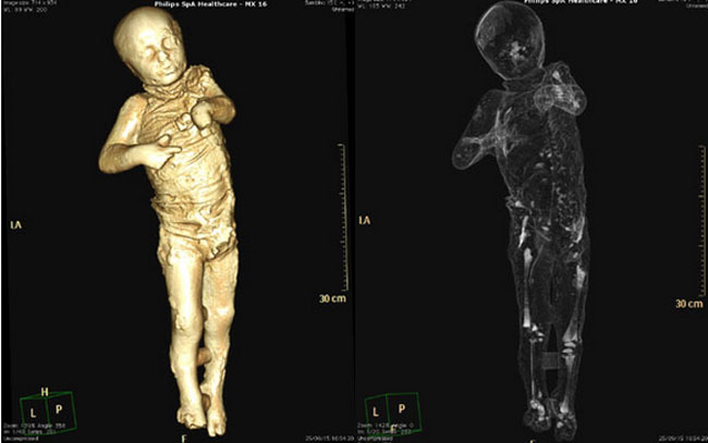 Тело и скелет второго ребенка из Дома золотого браслета